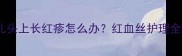 新生儿头上长红疹怎么办红血丝护理全攻略