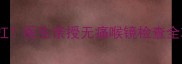 孕期喉部不适别硬扛医生亲授无痛喉镜检查全攻略附避坑指南