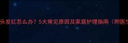 小孩手指头发红怎么办5大常见原因及家庭护理指南附医生建议