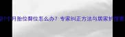 怀孕7个月胎位臀位怎么办专家纠正方法与居家护理要点