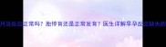 怀孕两个月没反应正常吗胎停育还是正常发育医生详解早孕反应缺失的8大原因