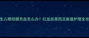 新生儿眼结膜充血怎么办红血丝原因及家庭护理全攻略