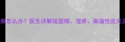 宝宝头上红疹像癣怎么办医生详解摇篮帽湿疹脂溢性皮炎及家庭护理指南