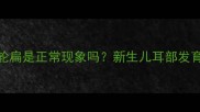 婴儿耳轮扁是正常现象吗新生儿耳部发育全攻略