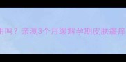 舒极芷痒王孕妇可用吗亲测3个月缓解孕期皮肤瘙痒附安全使用指南