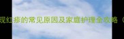 新生儿脸上出现红疹的常见原因及家庭护理全攻略附医生建议