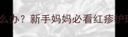三个月宝宝身上起红点怎么办新手妈妈必看红疹护理全攻略附医生建议