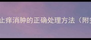 婴儿蚊虫叮咬后止痒消肿的正确处理方法附安全护理指南
