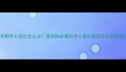 孕期手心发红怎么办准妈妈必看的手心发红原因及应对措施