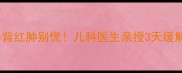 宝宝手背红肿别慌儿科医生亲授3天缓解法