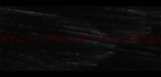 新生儿睡眠惊跳频繁怎么办儿科医生详解0-3月龄宝宝夜惊症状及科学应对方案