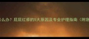 婴儿红疹怎么办屁屁红疹的5大原因及专业护理指南附急救方案