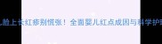 新生儿脸上长红疹别慌张全面婴儿红点成因与科学护理指南