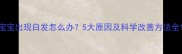 宝宝出现白发怎么办5大原因及科学改善方法全