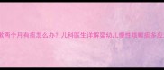 宝宝咳嗽两个月有痰怎么办儿科医生详解婴幼儿慢性咳嗽痰多应对指南
