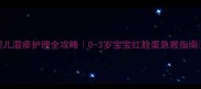 婴儿湿疹护理全攻略0-3岁宝宝红脸蛋急救指南