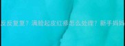 满月宝宝湿疹反反复复满脸起皮红疹怎么处理新手妈妈必看护理指南