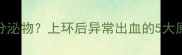 上环后半个月褐色分泌物上环后异常出血的5大原因及科学应对指南