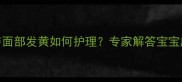 新生儿手部皮肤发黑与面部发黄如何护理专家解答宝宝皮肤异常的3个关键期