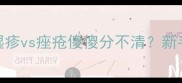 婴儿皮肤问题大湿疹vs痤疮傻傻分不清新手爸妈必看护理指南