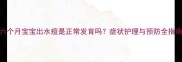 六个月宝宝出水痘是正常发育吗症状护理与预防全指南