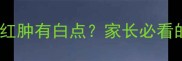 儿童咽喉健康全喉咙红肿有白点家长必看的家庭护理与就医指南
