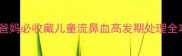 新手爸妈必收藏儿童流鼻血高发期处理全攻略