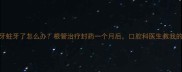 宝宝乳牙蛀牙了怎么办根管治疗封药一个月后口腔科医生教我的护理技巧