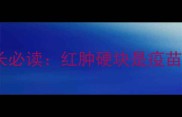 儿童疫苗接种后硬块家长必读红肿硬块是疫苗反应吗权威医学指南