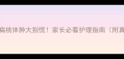 3岁宝宝扁桃体肿大别慌家长必看护理指南附真实案例
