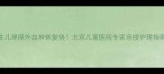 新生儿硬膜外血肿恢复快北京儿童医院专家亲授护理指南
