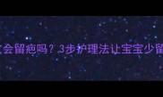 烫伤脱皮会留疤吗3步护理法让宝宝少留痕