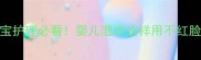 冬季宝宝护理必看婴儿湿巾这样用不红脸不皲裂